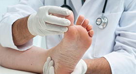 Tratamiento a la úlcera del pie diabético Heberprot-P